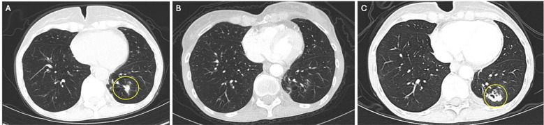 Figure 2