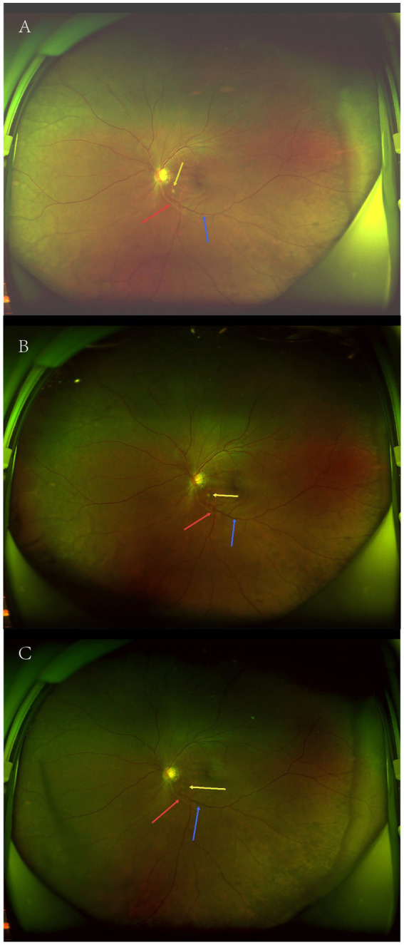 Figure 2
