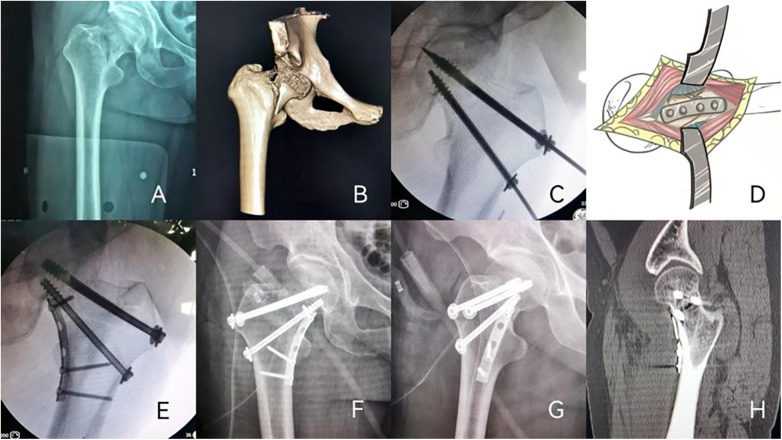 Figure 1