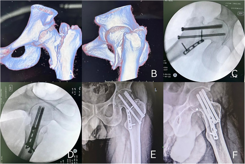 Figure 2