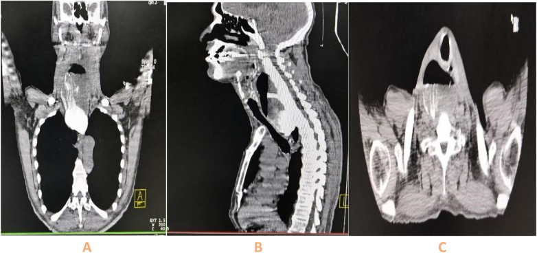 Figure 3