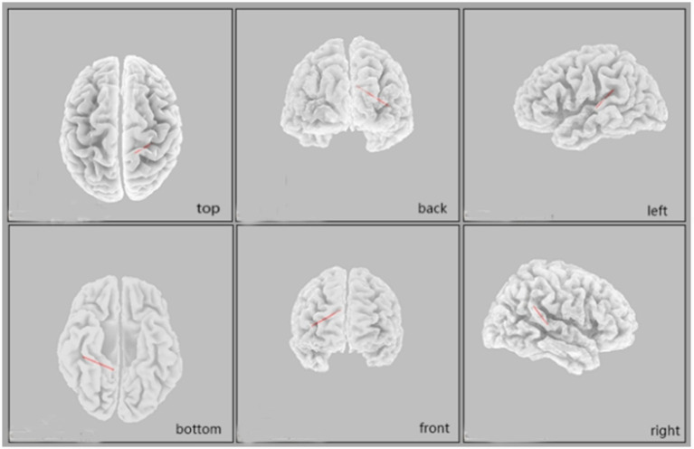 Figure 5