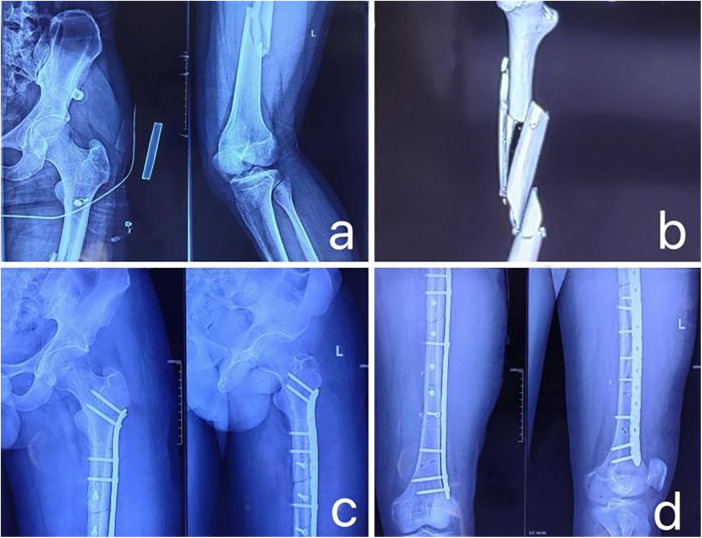 Figure 3