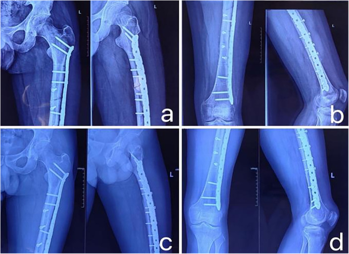 Figure 4