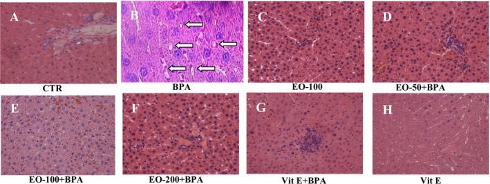FIGURE 14