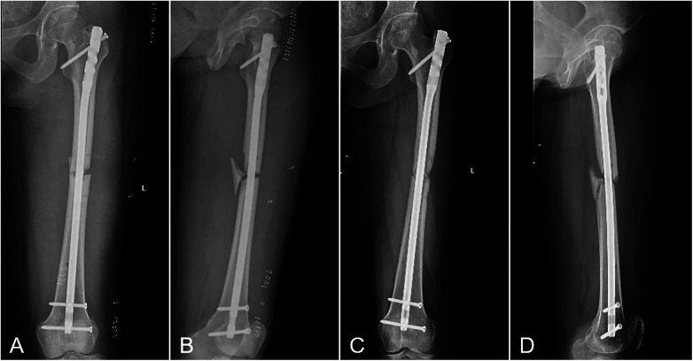 Figure 3