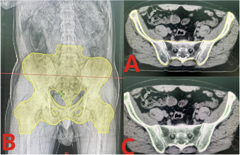 Figure 1