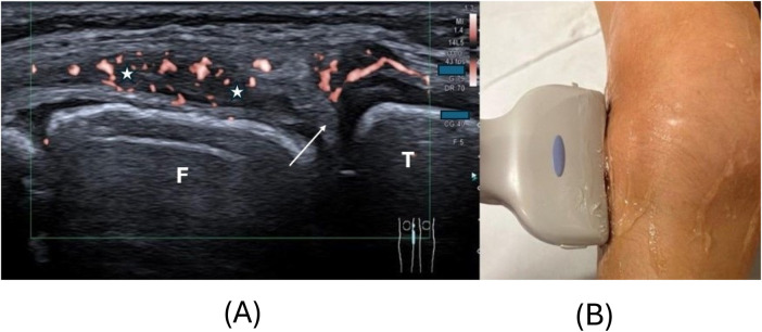 Figure 2