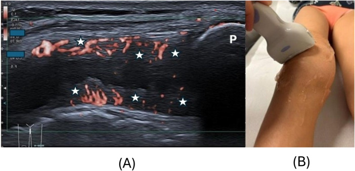 Figure 3