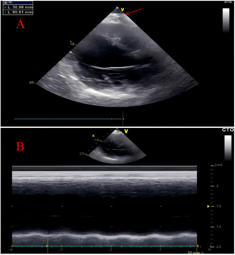 Figure 2