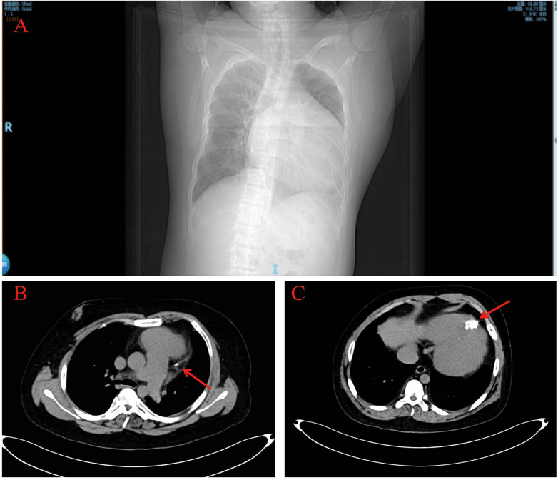 Figure 3