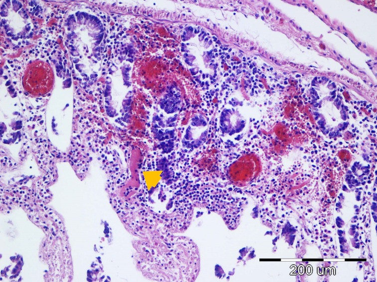 Figure 11