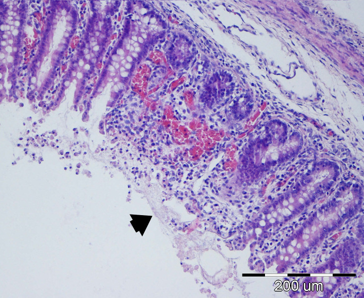 Figure 14
