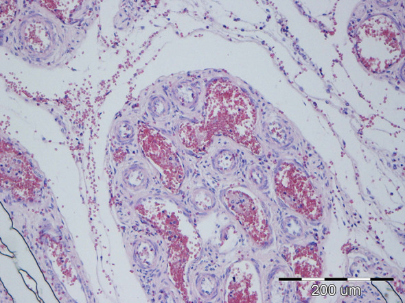 Figure 16