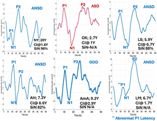Figure 11