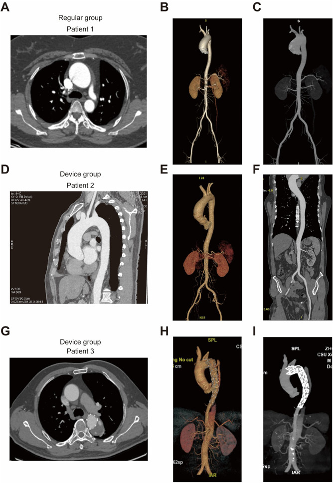 Figure 3