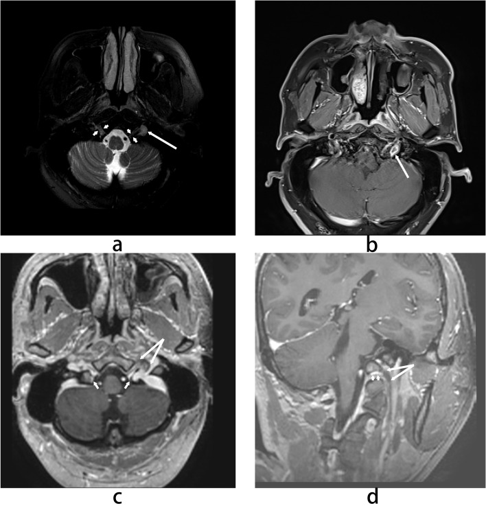 Figure 2