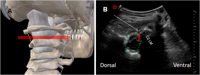 Figure 1