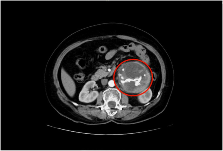 Figure 1