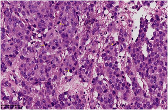 FIGURE 3