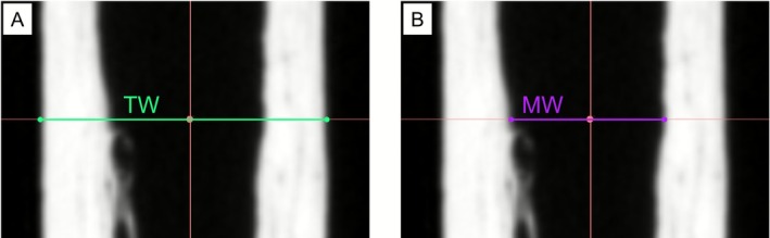 FIGURE 2