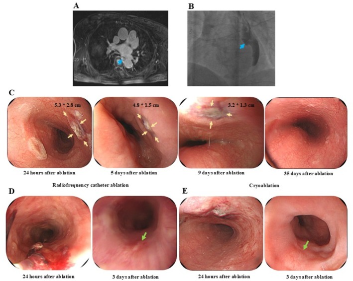 FIGURE 3