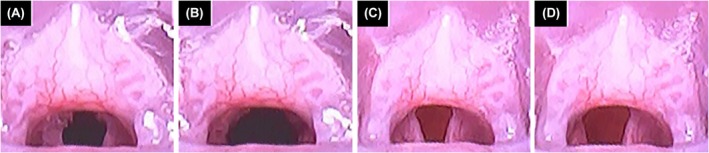 FIGURE 2