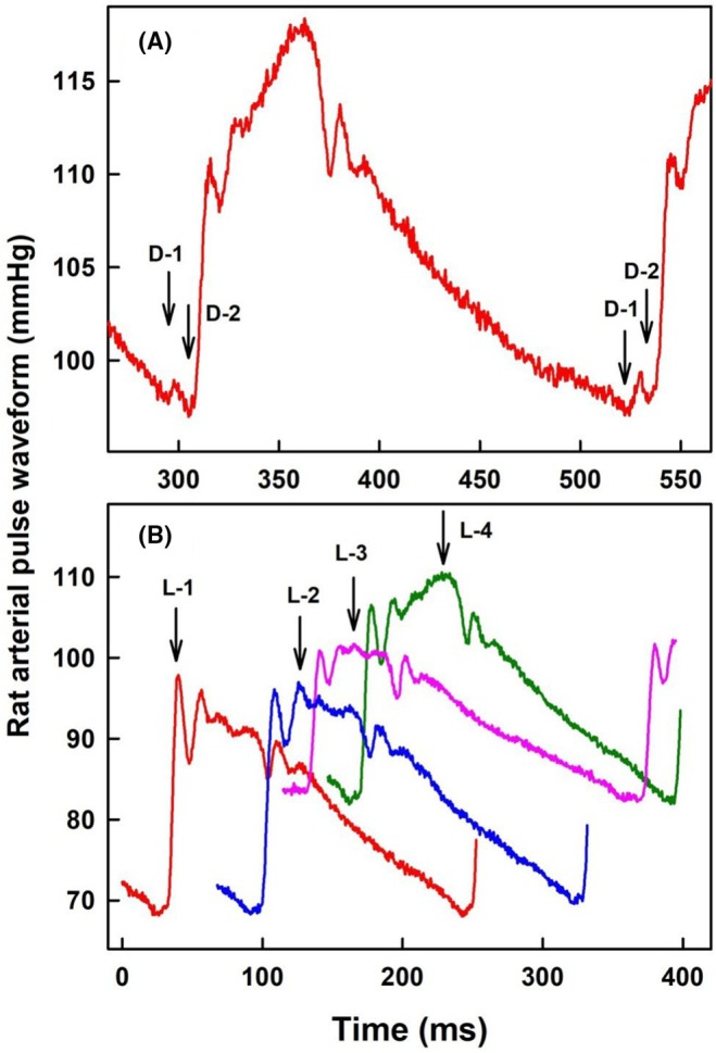 FIGURE 4