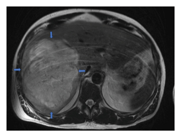 FIGURE 2