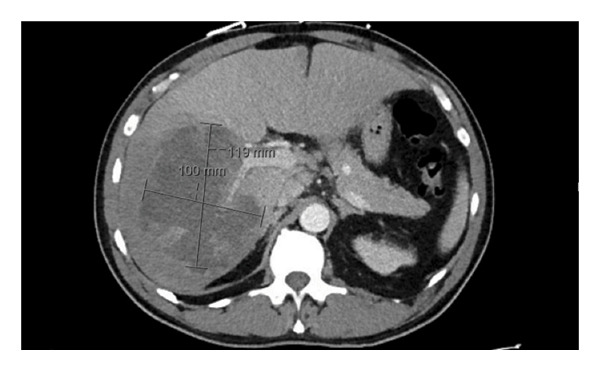FIGURE 1