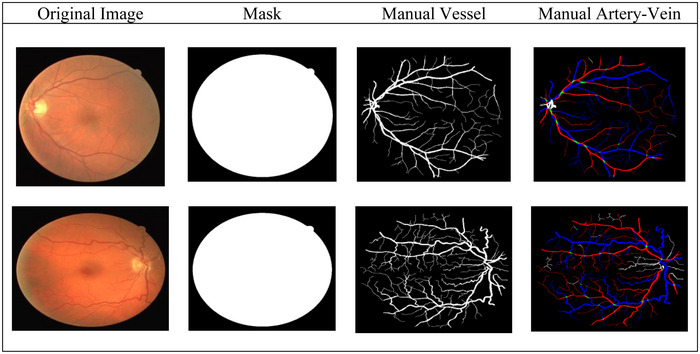 FIGURE 4
