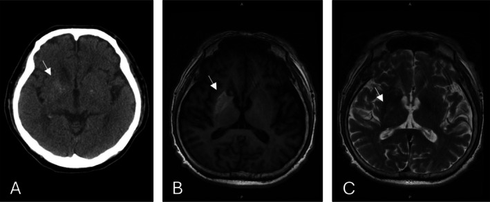 FIGURE 1