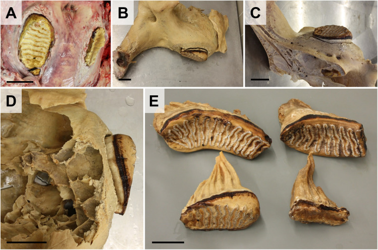 Fig 14
