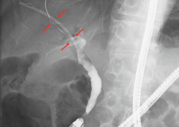 Fig. 4