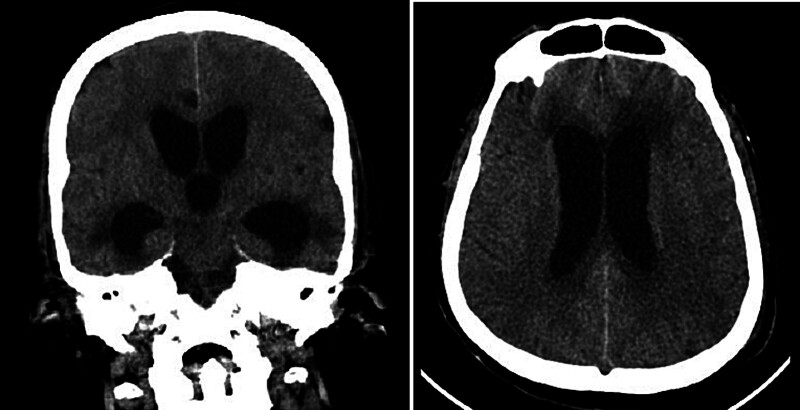 Fig. 2
