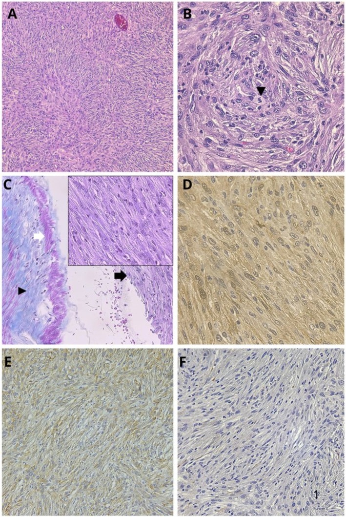 FIGURE 4