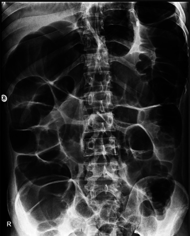 FIGURE 2