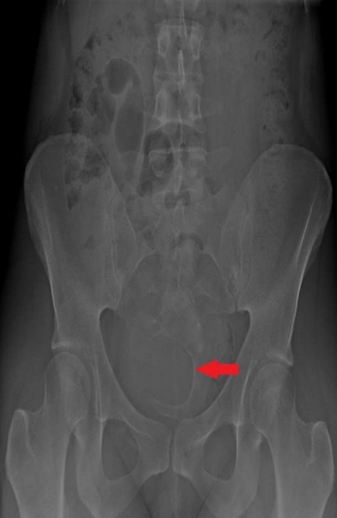 FIGURE 1