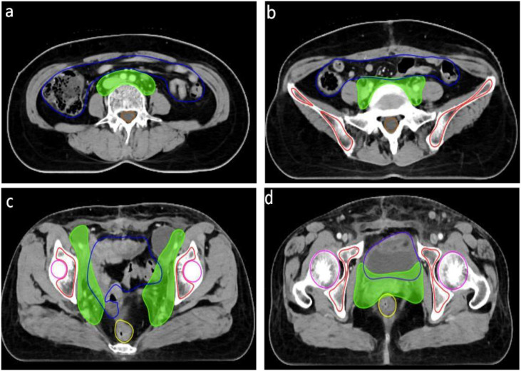 Figure 1