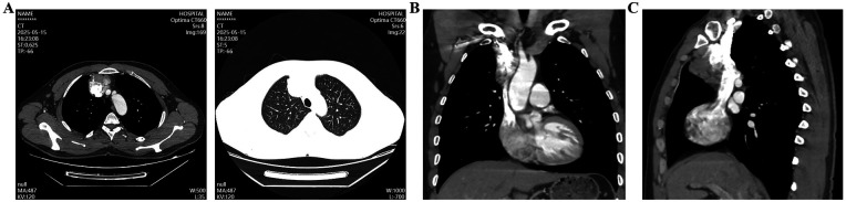 Figure 2