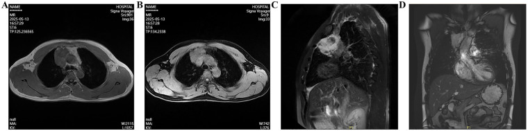 Figure 3