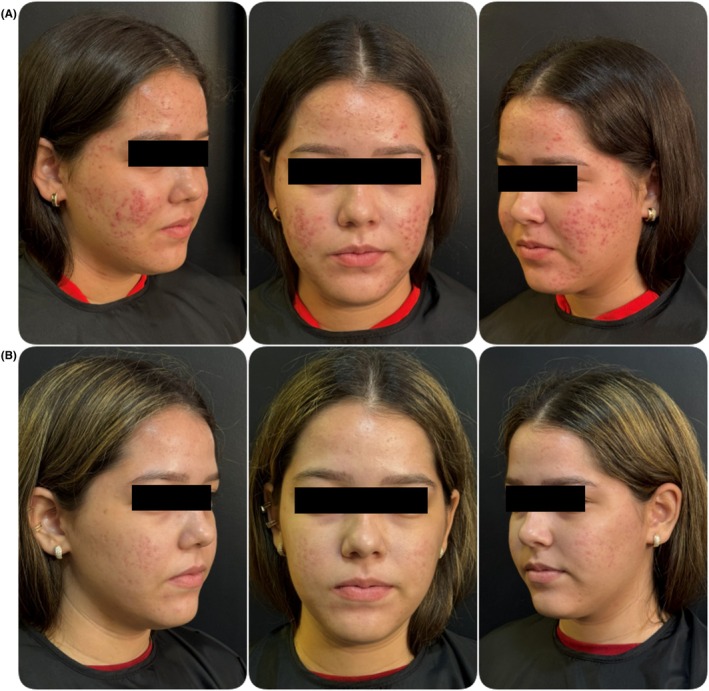 FIGURE 1