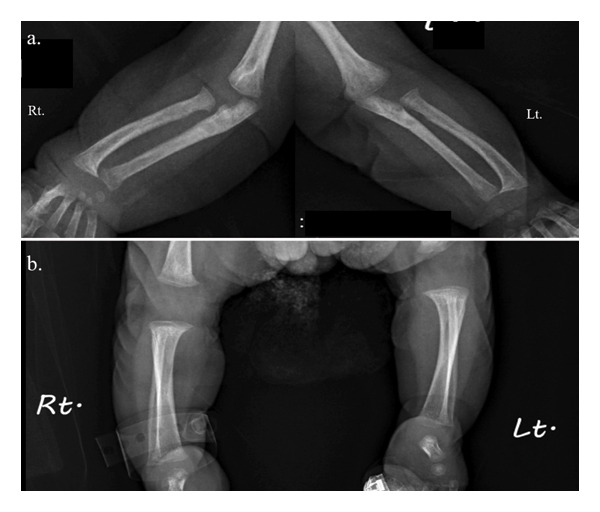 FIGURE 3