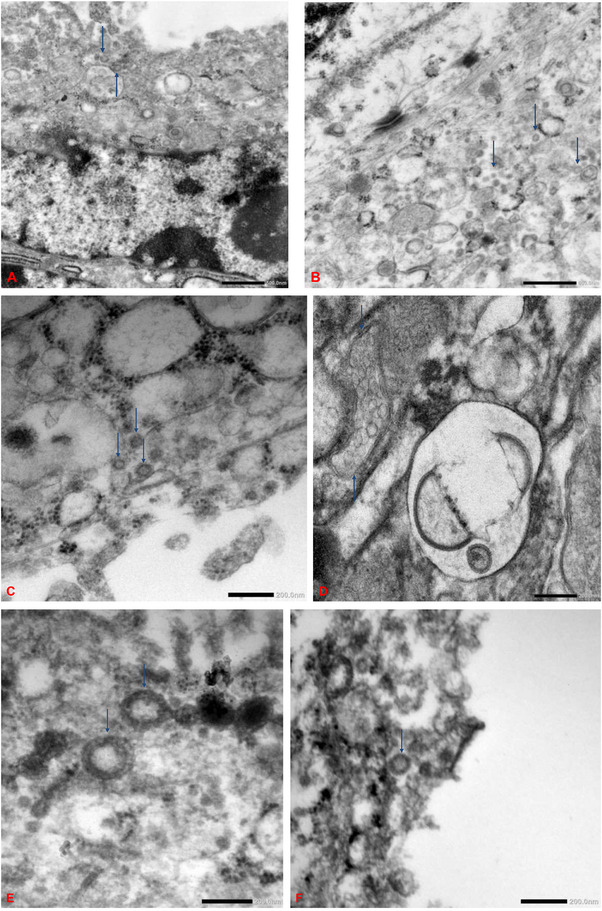 FIGURE 4