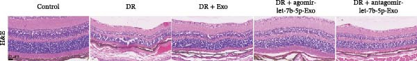 Figure 38