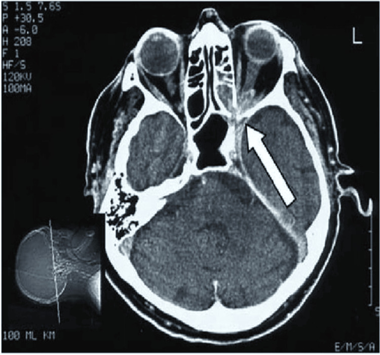 Figure 5