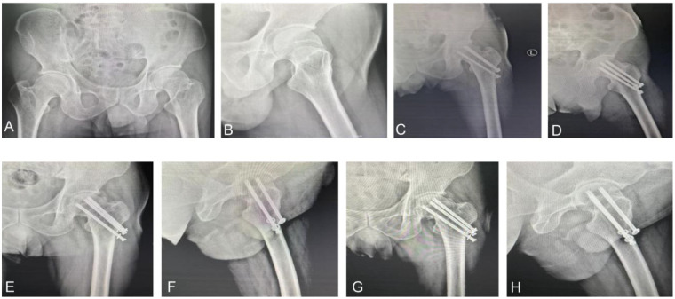 Figure 2
