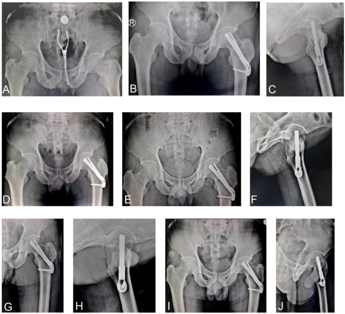 Figure 3