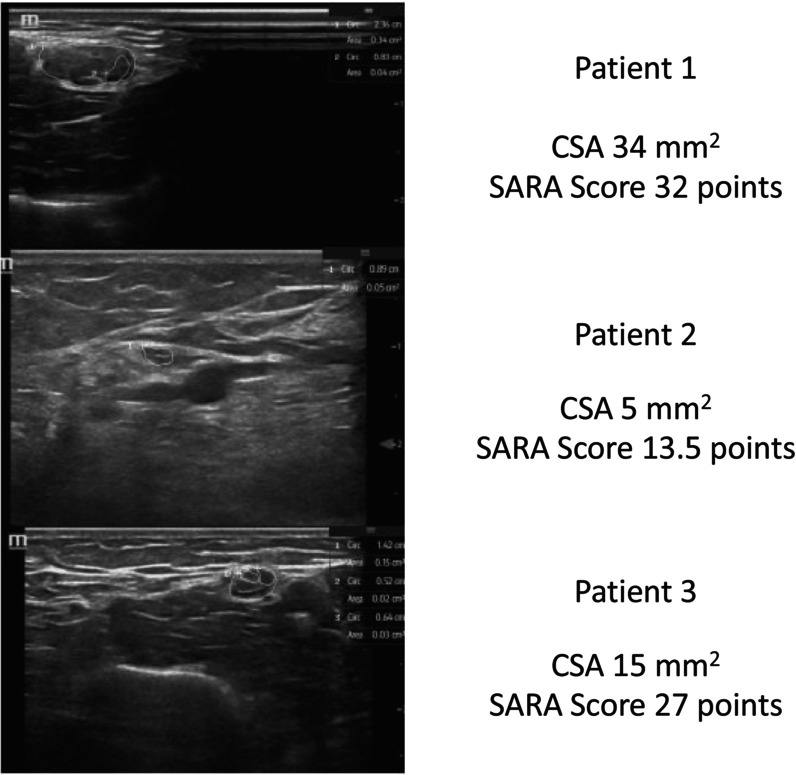 FIGURE 1