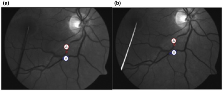 FIGURE 1